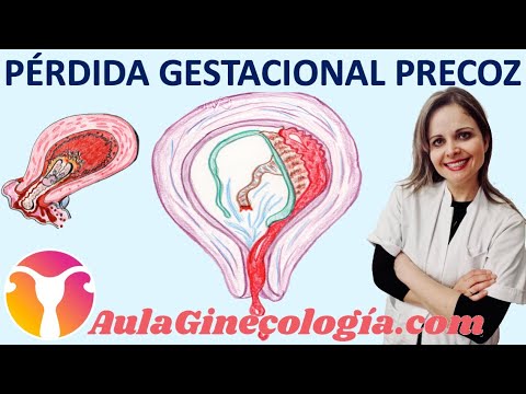 Video: ¿El hematoma causará un aborto espontáneo?