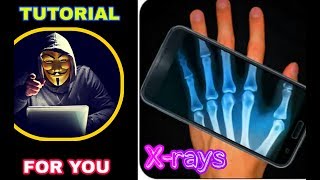 ফোন দিয়ে X-ray  করুন,, screenshot 3