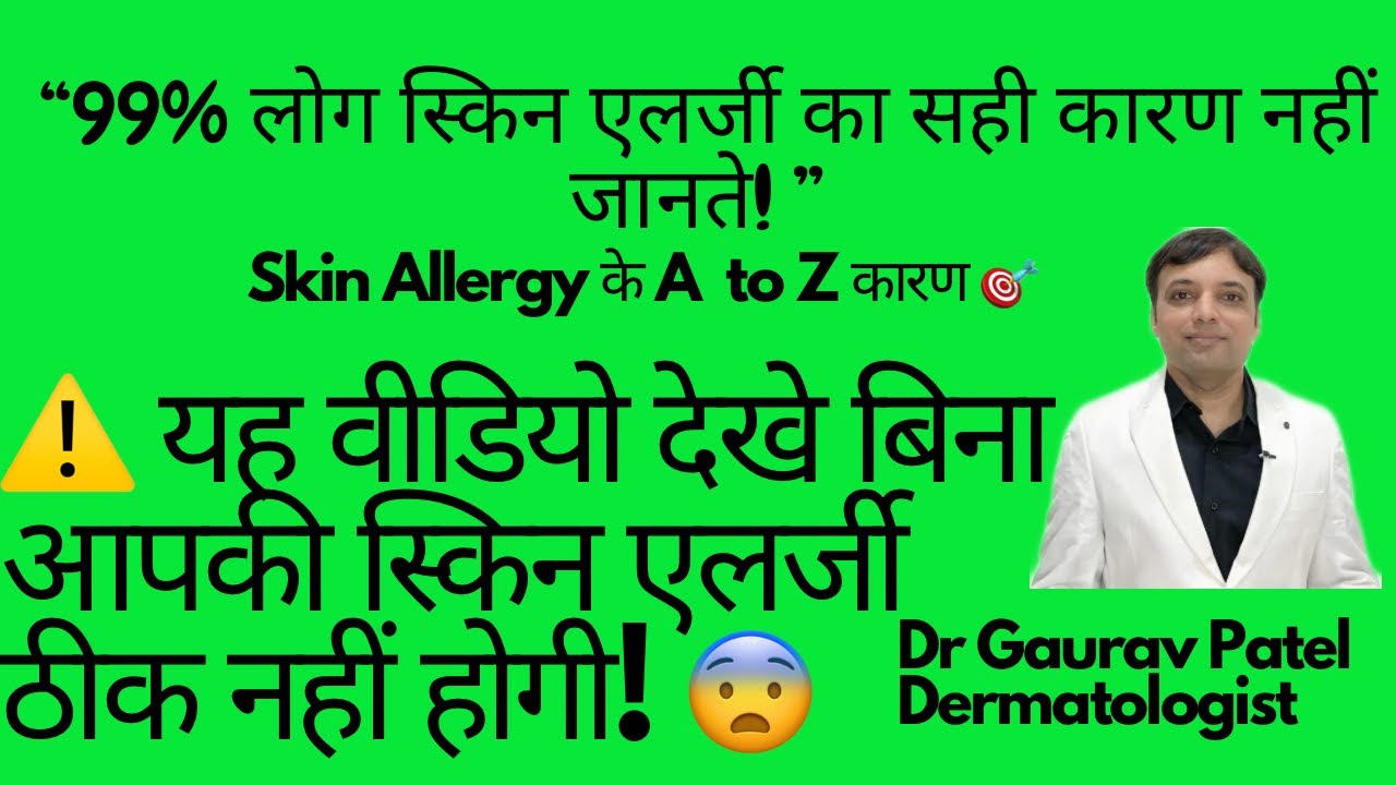 Skin Allergy kyu hoti hai| खुजली के कारण 😱 | Skin Allergy ke karan #Urticaria|Hives |Itching#khujli