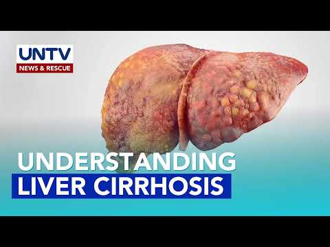 Liver Cirrhosis: Causes and Risk Factors explained by medical experts