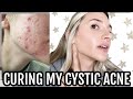 Curing My Hormonal Cystic Acne | All Natural, No Accutane | My Story