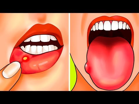 8 Señales de que tu cuerpo necesita más ácido fólico