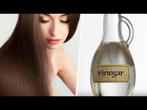 White Vinegar For Hair Loss | How To Stop Hair Fall At Home | Shammiz DIY