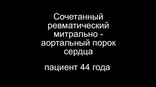 Сочетанный Митрально - Аортальный Порок Сердца. Видео 1995 Г.