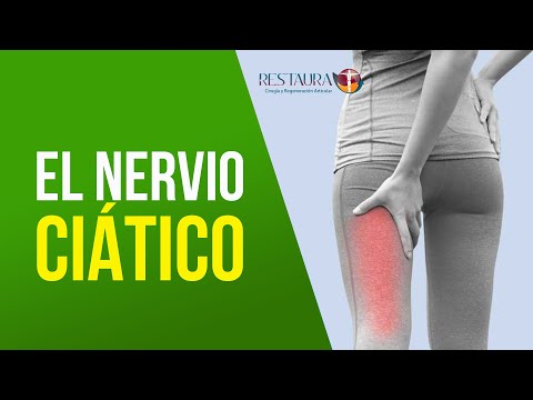 NERVIO CIÁTICO - DR RAMIRO RAMÍREZ GUTIÉRREZ