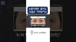 거울보기 싫으시죠? 1시간이면 해결됩니다