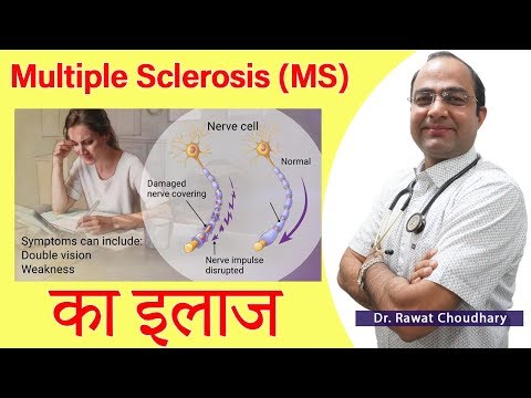 Multiple Sclerosis | Best Treatment of Multiple Sclerosis (MS) | Best Homeopathic Doctor