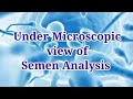 Under Microscopic view of Semen Analysis