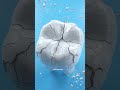 Why Can Your Finger Heal… But Your Tooth Can’t?
