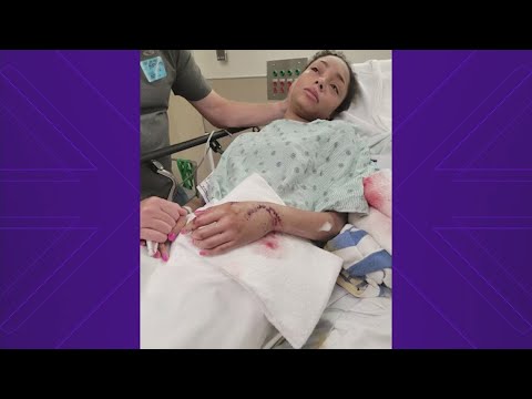 Woman says shark attacked her in Galveston so she punched it