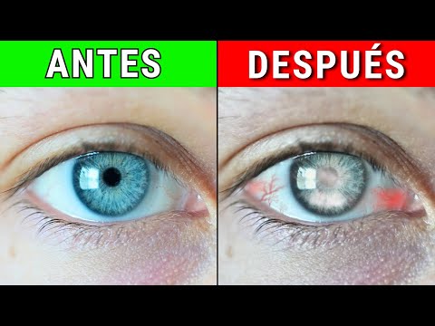 9 Hábitos Que Arruinan Tus Ojos (En Secreto) 10 peores hábitos para la salud de tus ojos