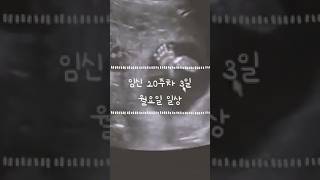 뚝딱일기 +169 | 30대 임산부 월요일 일상