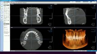 SOREDEX OnDemand3D Dental Module - tutoriál