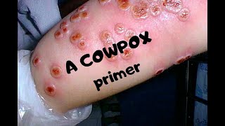 COWPOX: A primer on a now rare infection