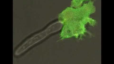Time-Lapse: Amoeba Phagocytosis of Yeast by Dr. Margaret Clarke