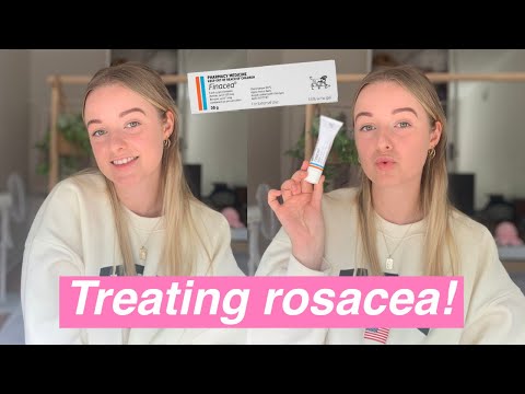 Finacea review for treating rosacea | High strength azelic acid?!