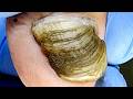 There Is Mud Hidden Under The Black Toenails Clean It Up【Xue Yidao】