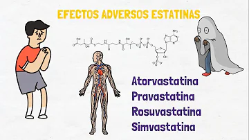 ¿Pueden las estatinas afectar a las piernas?