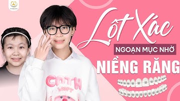 Lột Xác Ngoạn Mục Nhờ Niềng Răng – Xem Là Muốn Làm Ngay | Bác sĩ Trung Long Biên