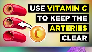 Vitamin C For Preventing Clogged Arteries screenshot 5