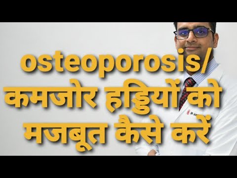 वीडियो: ऑस्टियोपोरोसिस का निदान कैसे करें: 12 कदम (चित्रों के साथ)