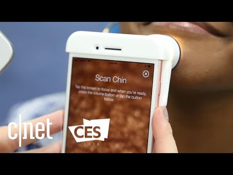 Video: Nieuw Apparaat Om Huid Skin360 Neutrogena Te Analyseren