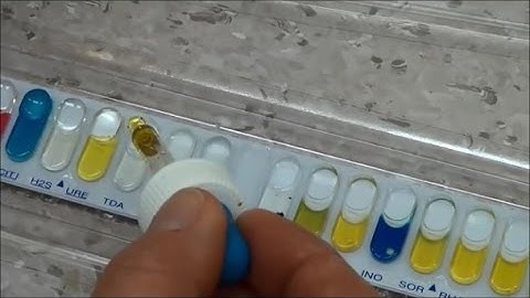 Performing an API 20E strip test