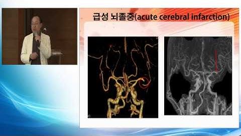 [서울성모병원] 뇌졸중 건강강좌 1. 뇌졸중의 이해(신경과 이광수 교수)