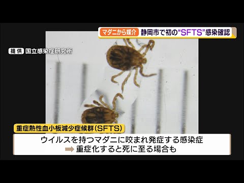 マダニから媒介　静岡市で初の“ＳＦＴＳ”感染確認