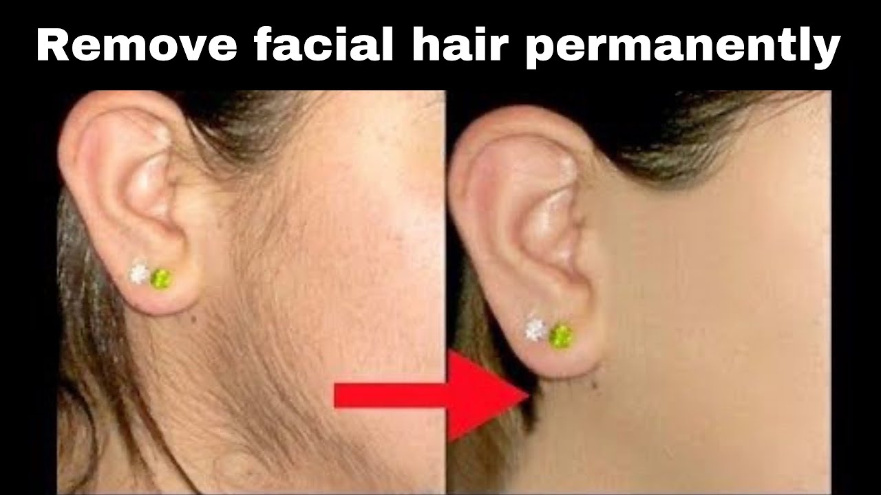 How to Remove Facial Hair Permanently Remove Facial Hair Natural at