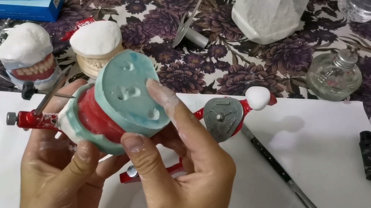 طريقة تثبيت الكاستات على الارتكليتر ،،،،،، صناعه اسنان