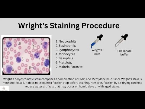 Wright Giemsa Stain Staining Technique Definition Components Preparation Procedure Application