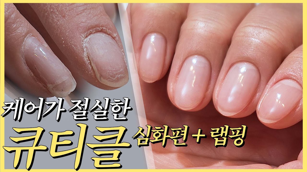 케어가 절실한 큐티클 심화편!! 찢어진 손톱 랩핑은 이렇게!