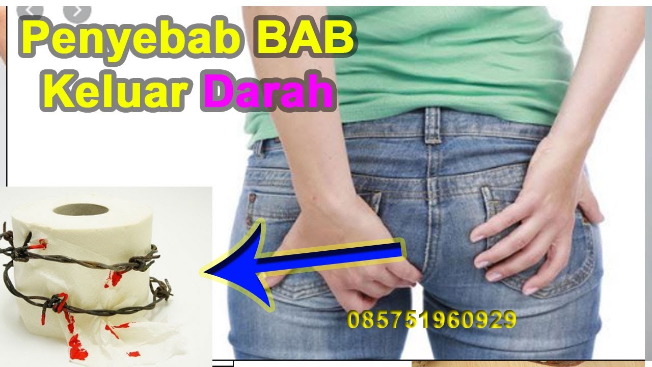 Penyebab BAB Keluar Darah Dan Cara Mengatasinya YouTube