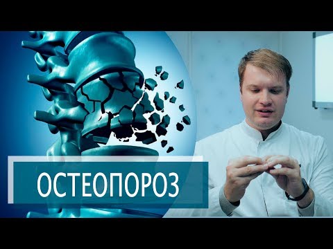 Видео: Колко вероятно е, че ще счупя кост, ако имам остеопороза?