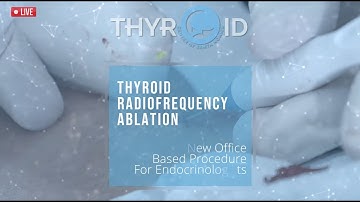 Thyroid RFA Ablation Master Course