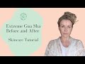 Extreme Gua Sha Before and After   Skincare Tutorial by Katie Brindle