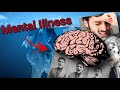 Mental Illness Iceberg Explained - Into the Mind