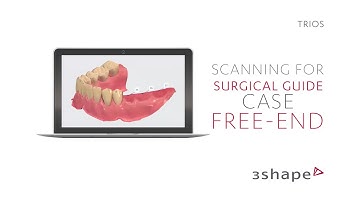 3Shape TRIOS - Scanning for surgical guide - Free-end case