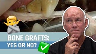 Veterinary Dentist  REVEALS His Answer: Should We Be Using Bone Grafts In Extraction Sites?