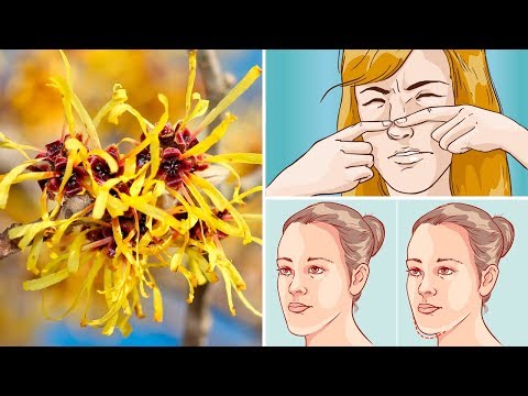 How to Use Witch Hazel to Clear Up Your Skin Naturally