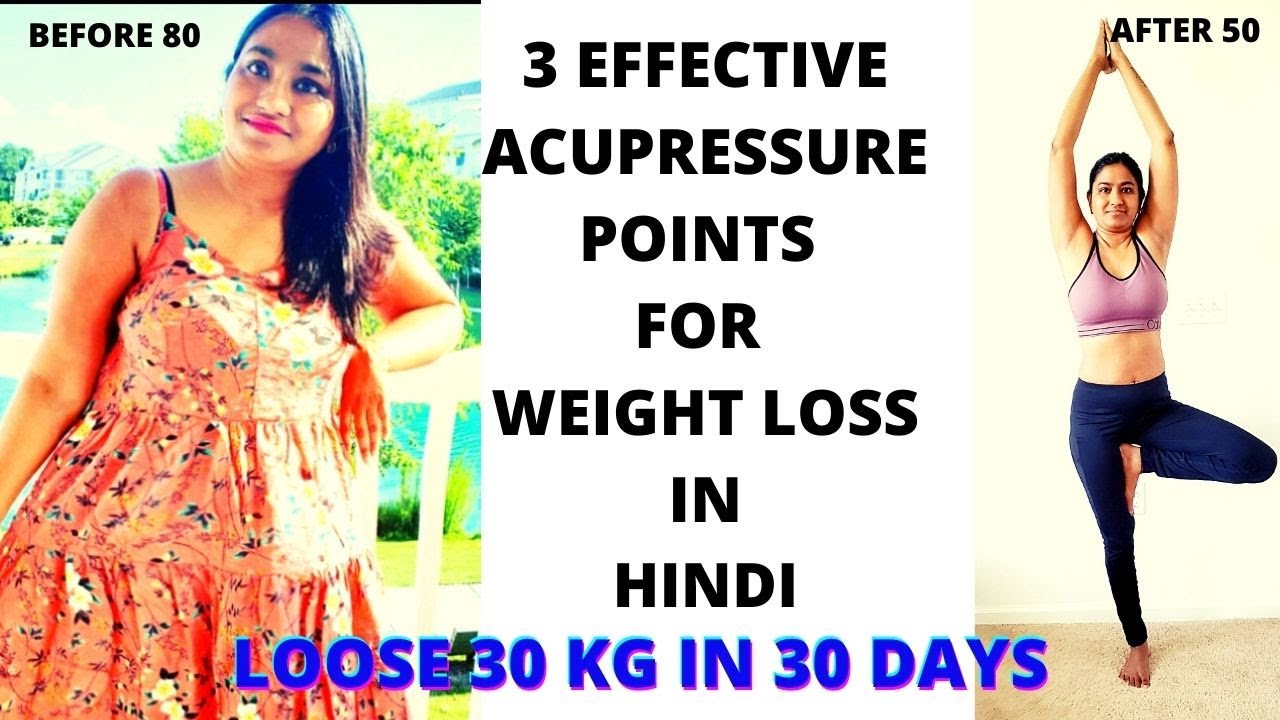 weight loss surgery 3 Effective acupressure points for weight loss