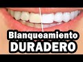 𝐃𝐢𝐞𝐧𝐭𝐞𝐬 𝐁𝐋𝐀𝐍𝐂𝐎𝐒 𝐞𝐧 𝟏 𝐃Í𝐀  🦷 Blanqueamiento Dental Madrid  𝐅𝐔𝐍𝐂𝐈𝐎𝐍𝐀 ✔️✔️✔️✔️