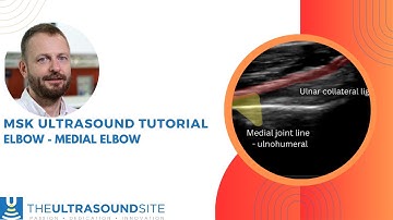 How to ultrasound the medial elbow - try it now!
