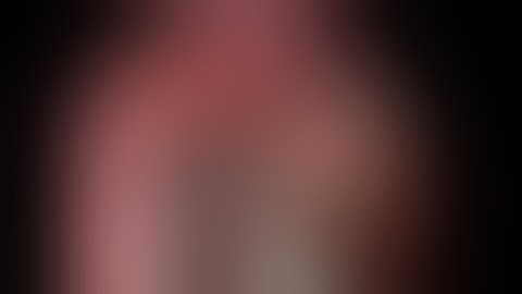 Uniportal VATS Anatomic Left Basal Segmentectomy (S7-10)