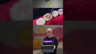 Proses tambal gigi