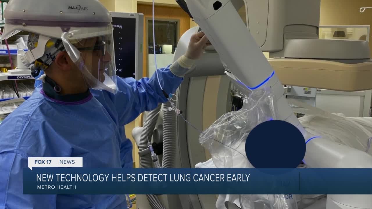 Robotic technology used to diagnose early stage lung cancer - YouTube