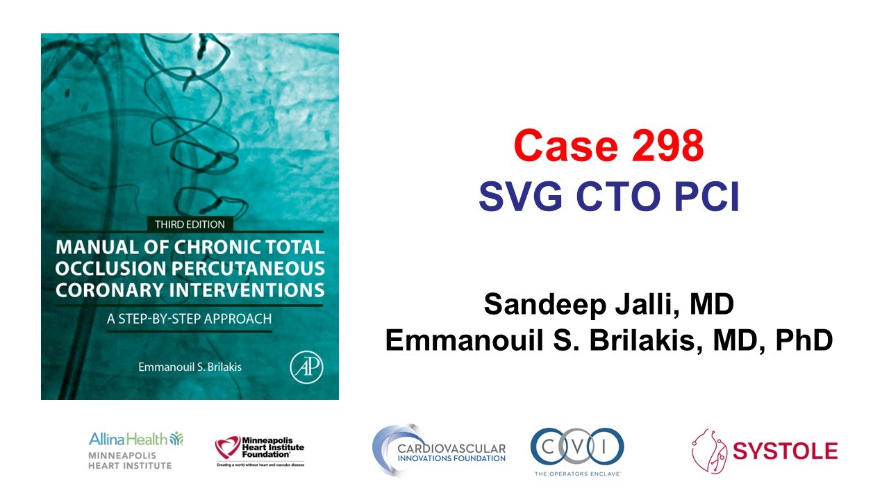 Case 298: Manual of CTO PCI - SVG CTO PCI - YouTube