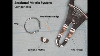 Placement of Sectional Matrix System