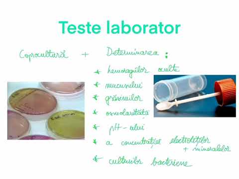 Video: Tipuri De Icter: Cauze, Tratamente, Diagnostic și Multe Altele